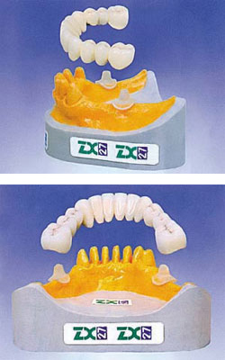 System szklanych podparć- Dentysta Lubań